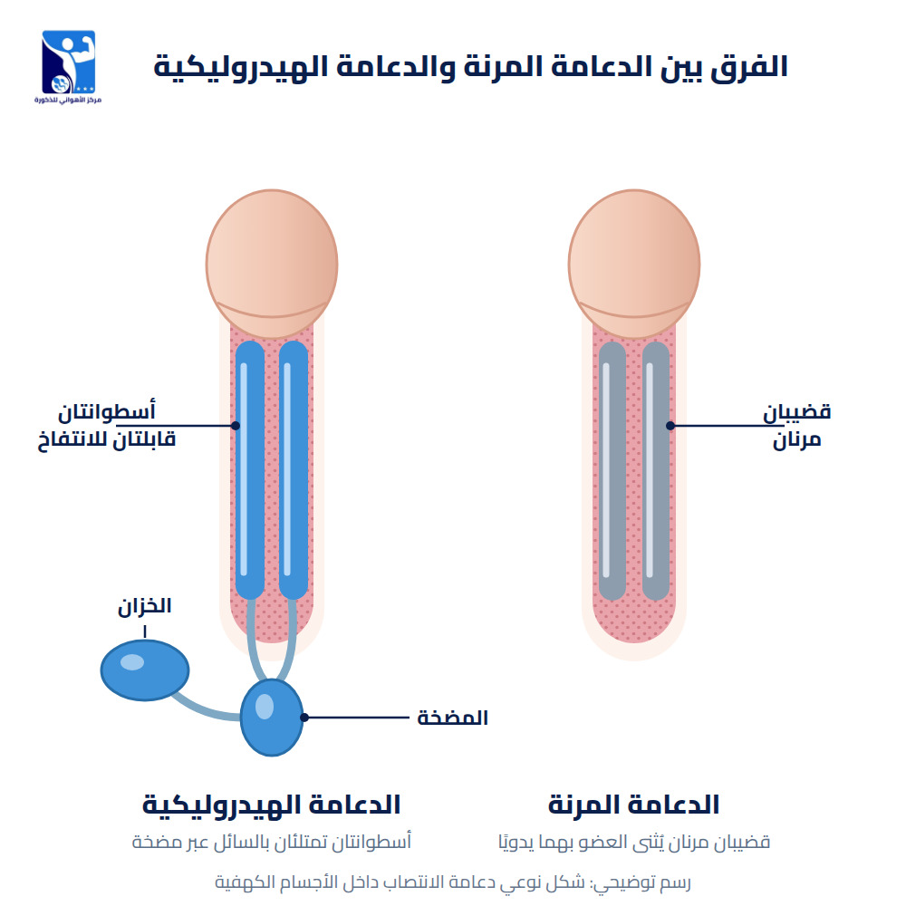 الفرق بين الدعامة المرنة والدعامة الهيدروليكية للقضيب